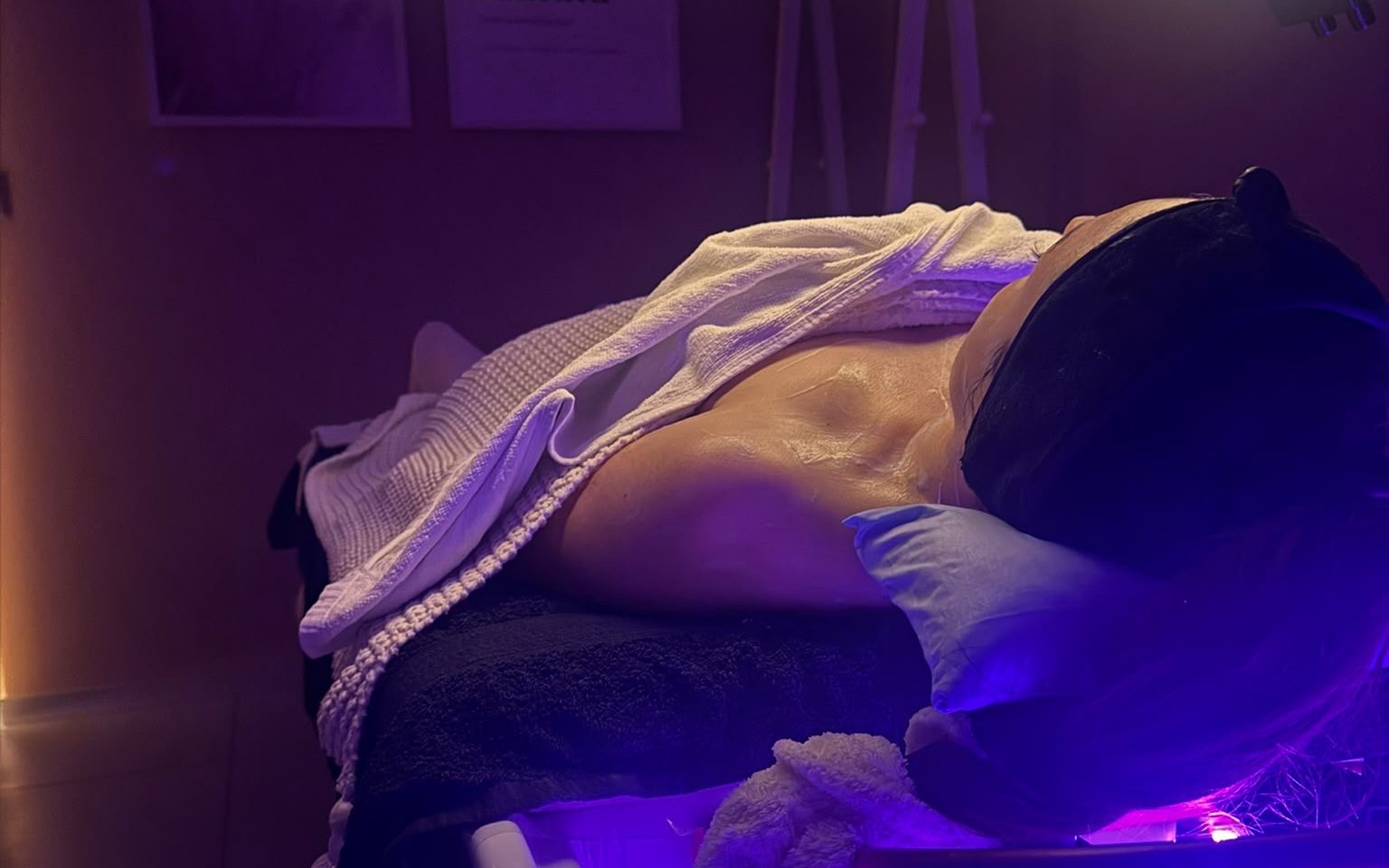 Séance d'épilation laser à l'institut mySkin Delémont